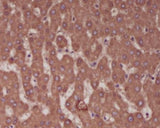 Anti-Alkaline Phosphatase ALPL Rabbit Monoclonal Antibody Boster Bio