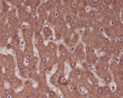 Anti-Alkaline Phosphatase ALPL Rabbit Monoclonal Antibody Boster Bio