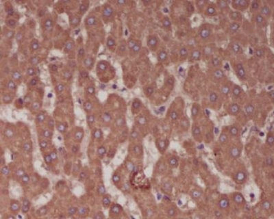 Anti-Alkaline Phosphatase ALPL Rabbit Monoclonal Antibody Boster Bio