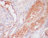Anti-C9/Complement Component C9 Rabbit Monoclonal Antibody Boster Bio