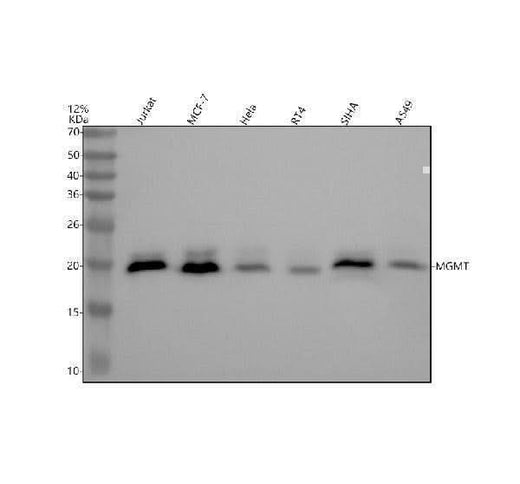 Anti-MGMT Rabbit Monoclonal Antibody Boster Bio
