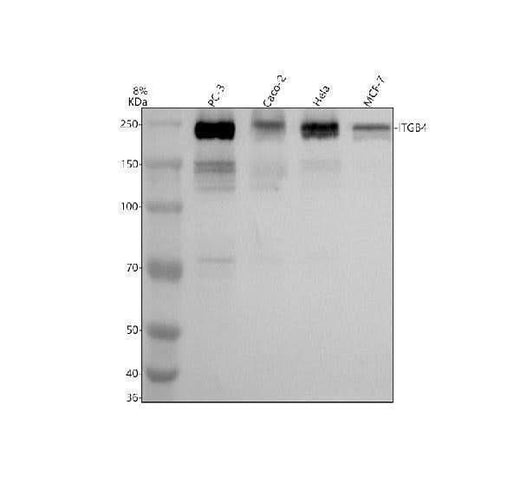 Anti-Integrin beta 4 ITGB4 Rabbit Monoclonal Antibody Boster Bio