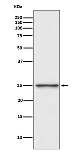 Anti-PGP9.5 Rabbit Monoclonal Antibody Boster Bio