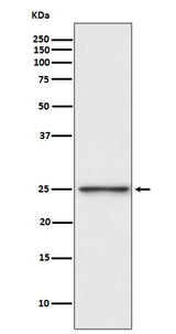 Anti-PGP9.5 Rabbit Monoclonal Antibody Boster Bio