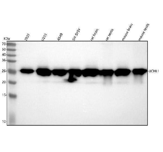 Anti-PGP9.5 UCHL1 Rabbit Monoclonal Antibody Boster Bio