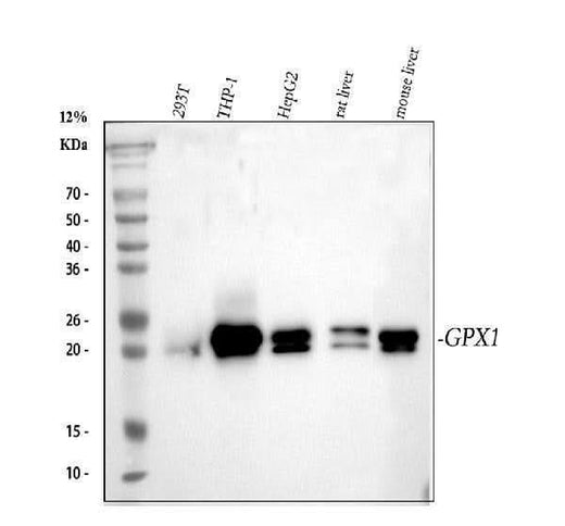 Anti-GPX1/Glutathione Peroxidase 1 Rabbit Monoclonal Antibody Boster Bio