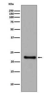 Anti-GPX1/Glutathione Peroxidase 1 Rabbit Monoclonal Antibody Boster Bio