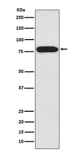 Anti-IRAK IRAK1 Monoclonal Antibody Boster Bio