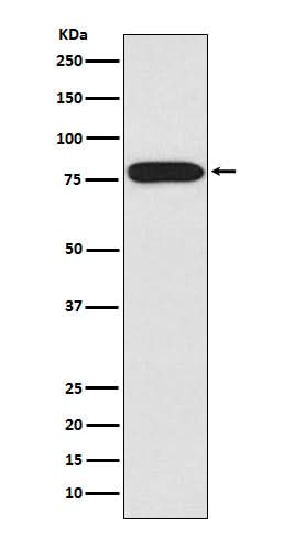 Anti-IRAK IRAK1 Monoclonal Antibody Boster Bio