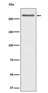Anti-CD35 Rabbit Monoclonal Antibody Boster Bio