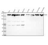 Anti-ROCK2 Monoclonal Antibody Boster Bio
