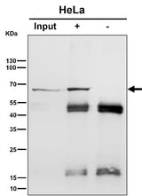 Anti-Hsp70 Rabbit Monoclonal Antibody Boster Bio