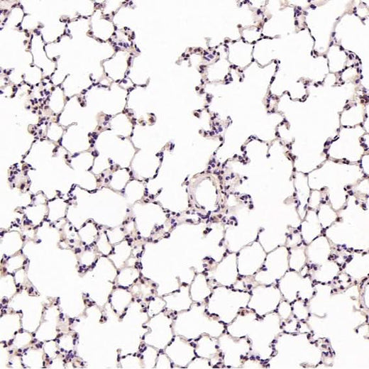 Anti-Hsc70 HSPA8 Rabbit Monoclonal Antibody Boster Bio