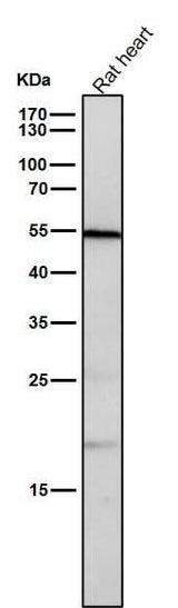 Anti-CD209 Rabbit Monoclonal Antibody Boster Bio