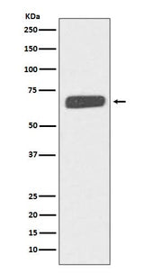 Anti-Collagen X COL10A1 Rabbit Monoclonal Antibody Boster Bio