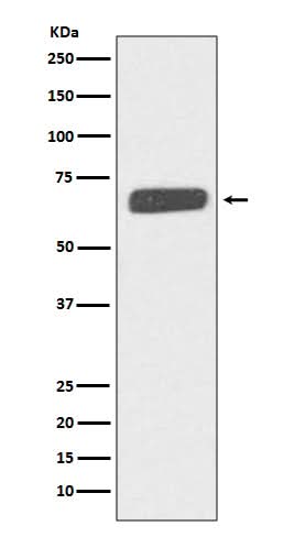 Anti-Collagen X COL10A1 Rabbit Monoclonal Antibody Boster Bio