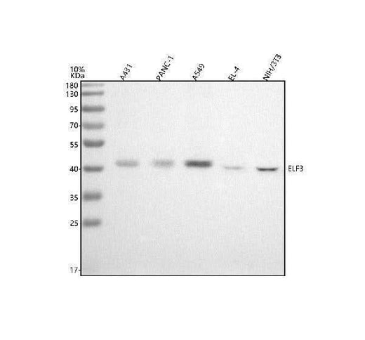 Anti-ESE1 Rabbit Monoclonal Antibody Boster Bio
