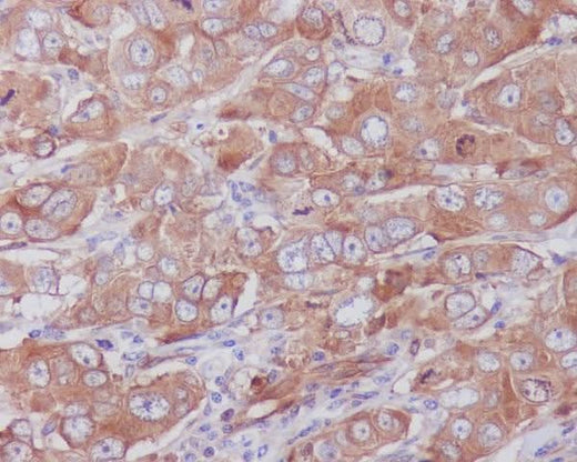 Anti-Paxillin PXN Rabbit Monoclonal Antibody Boster Bio