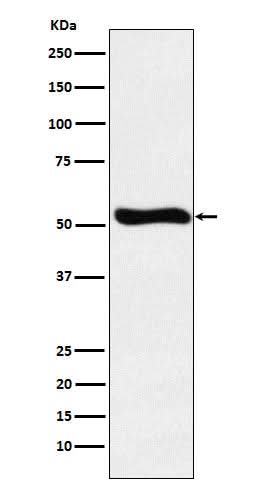 Anti-Lumican Rabbit Monoclonal Antibody Boster Bio
