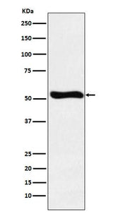 Anti-Lumican Rabbit Monoclonal Antibody Boster Bio