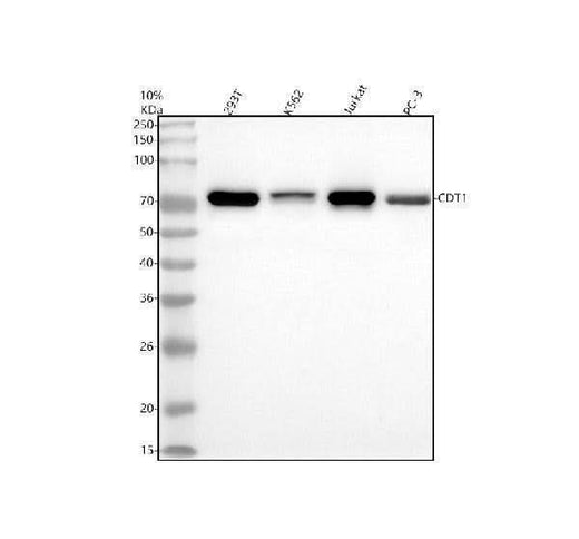 Anti-CDT1 Rabbit Monoclonal Antibody Boster Bio