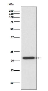 Anti-TIMP2 Rabbit Monoclonal Antibody Boster Bio
