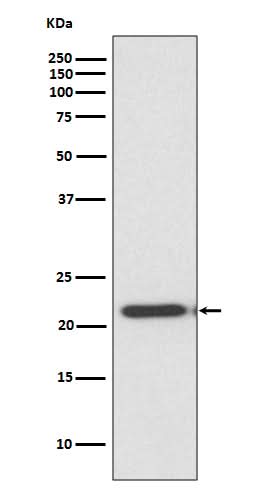 Anti-TIMP2 Rabbit Monoclonal Antibody Boster Bio
