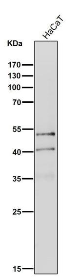 Anti-NeuroD1 Rabbit Monoclonal Antibody Boster Bio