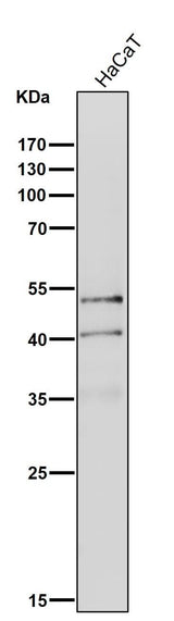 Anti-NeuroD1 Rabbit Monoclonal Antibody Boster Bio