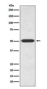 Anti-Endothelin B Receptor EDNRB Rabbit Monoclonal Antibody Boster Bio