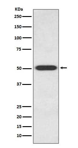 Anti-Endothelin B Receptor EDNRB Rabbit Monoclonal Antibody Boster Bio