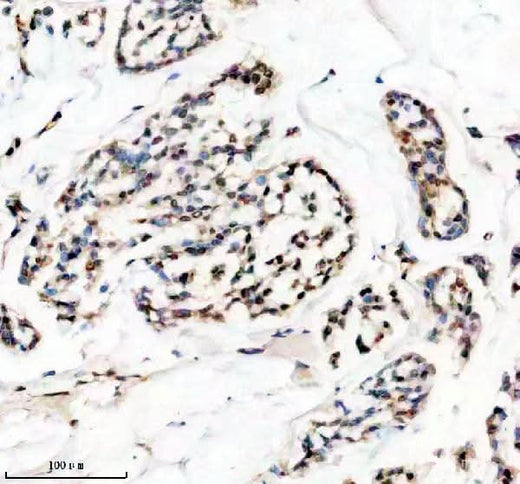 Anti-HMGA1 Rabbit Monoclonal Antibody Boster Bio