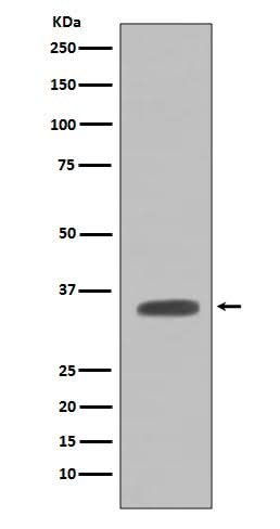 Anti-Caspase-7 Casp7 Rabbit Monoclonal Antibody Boster Bio