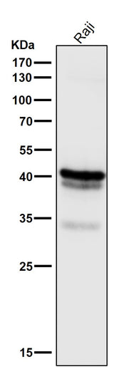Anti-CD79a Monoclonal Antibody Boster Bio