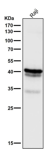 Anti-CD79a Monoclonal Antibody Boster Bio