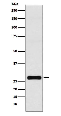 Anti-GJB1 Rabbit Monoclonal Antibody Boster Bio