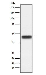 Anti-TFPI Rabbit Monoclonal Antibody Boster Bio