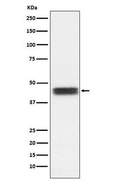 Anti-TFPI Rabbit Monoclonal Antibody Boster Bio