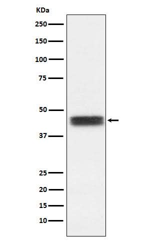 Anti-TFPI Rabbit Monoclonal Antibody Boster Bio