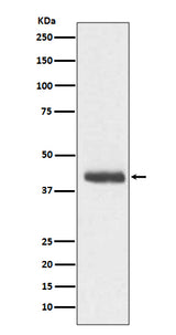 Anti-DCX/Doublecortin Rabbit Monoclonal Antibody Boster Bio