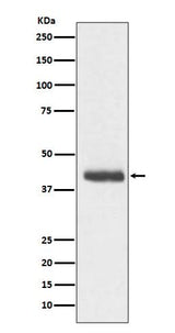 Anti-DCX/Doublecortin Rabbit Monoclonal Antibody Boster Bio