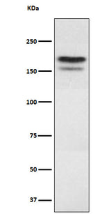 Anti-EHMT2 Rabbit Monoclonal Antibody Boster Bio