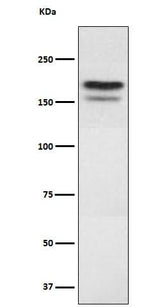 Anti-EHMT2 Rabbit Monoclonal Antibody Boster Bio