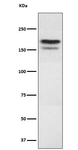 Anti-EHMT2 Rabbit Monoclonal Antibody Boster Bio
