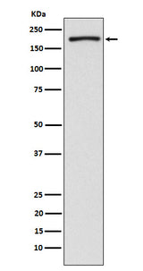 Anti-EHMT2/G9A Rabbit Monoclonal Antibody Boster Bio