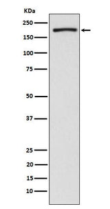 Anti-EHMT2/G9A Rabbit Monoclonal Antibody Boster Bio