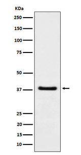 Anti-HDGF Rabbit Monoclonal Antibody Boster Bio