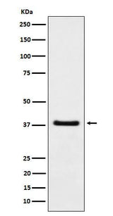 Anti-HDGF Rabbit Monoclonal Antibody Boster Bio