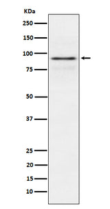 Anti-RSK1 p90 Rabbit Monoclonal Antibody Boster Bio