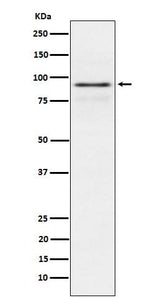 Anti-RSK1 p90 Rabbit Monoclonal Antibody Boster Bio
